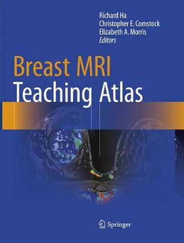 Cover image for Breast MRI Teaching Atlas