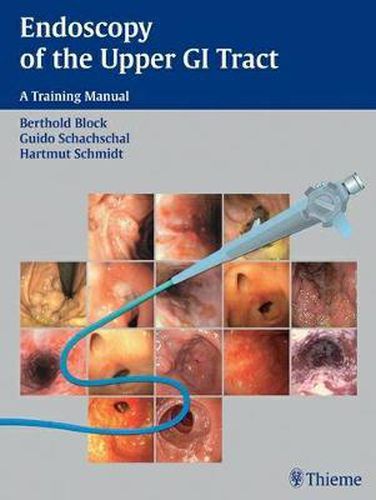 Cover image for Endoscopy of the Upper GI Tract: A Training Manual