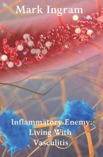Inflammatory Enemy