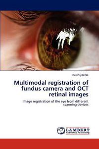 Cover image for Multimodal registration of fundus camera and OCT retinal images