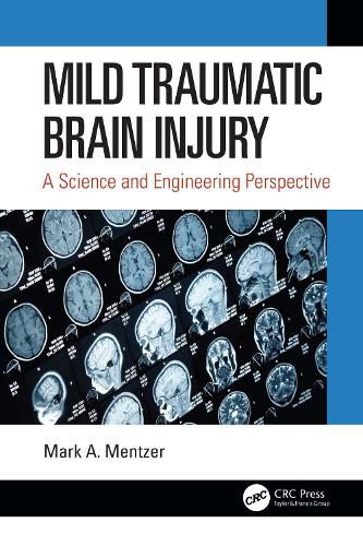 Cover image for Mild Traumatic Brain Injury