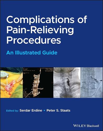Cover image for Complications of Pain-Relieving Procedures - An Illustrated Guide