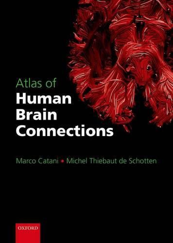 Cover image for Atlas of Human Brain Connections