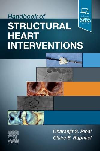 Cover image for Handbook of Structural Heart Interventions