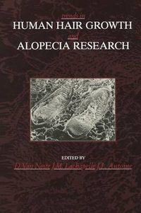 Cover image for Trends in Human Hair Growth and Alopecia Research