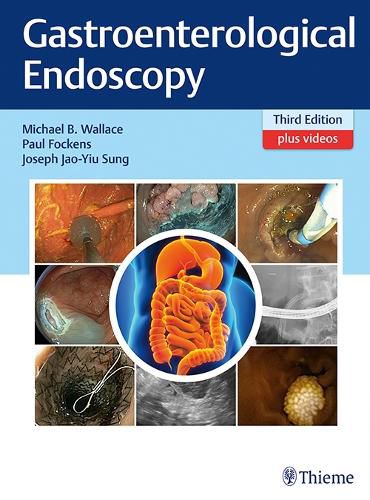 Cover image for Gastroenterological Endoscopy