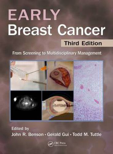 Cover image for Early Breast Cancer: From Screening to Multidisciplinary Management, Third Edition