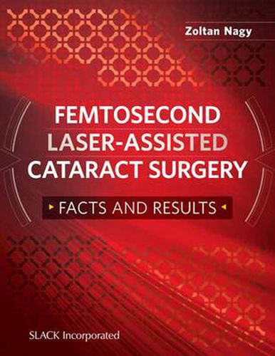 Cover image for Femtosecond Laser-Assisted Cataract Surgery: Facts and Results