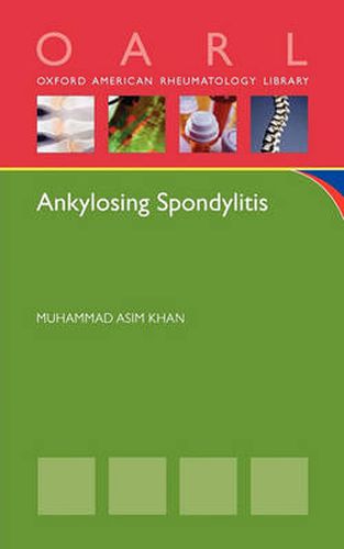 Cover image for Ankylosing Spondylitis