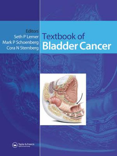 Cover image for Textbook of Bladder Cancer