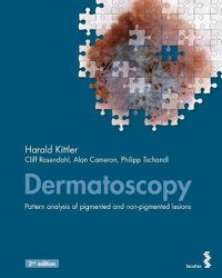 Cover image for Dermatoscopy: Pattern analysis of pigmented and non-pigmented lesions