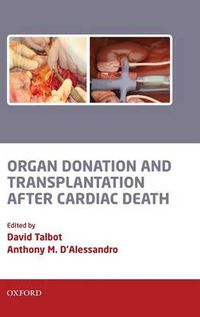 Cover image for Organ Donation and Transplantation after Cardiac Death