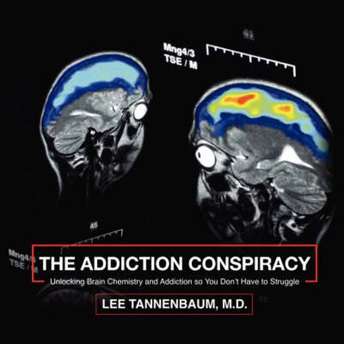 Cover image for The Addiction Conspiracy: Unlocking Brain Chemistry and Addiction So You Don't Have to Struggle
