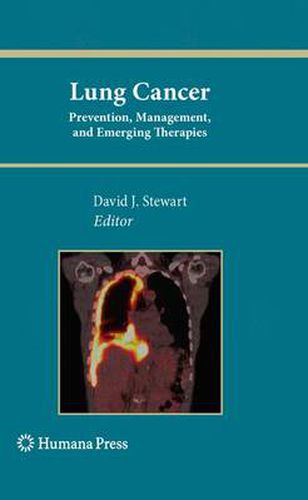 Cover image for Lung Cancer:: Prevention, Management, and Emerging Therapies