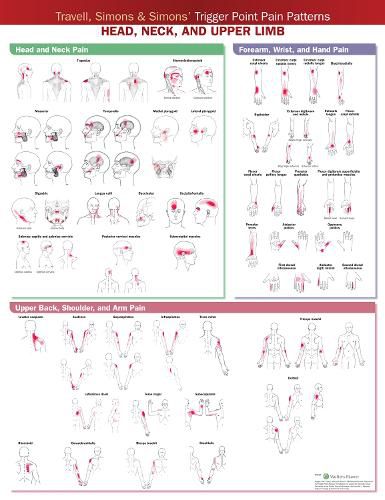 Cover image for Travell, Simons & Simons' Trigger Point Pain Patterns Wall Chart