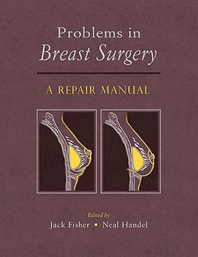 Cover image for Problems in Breast Surgery: A Repair Manual