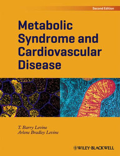 Cover image for Metabolic Syndrome and Cardiovascular Disease