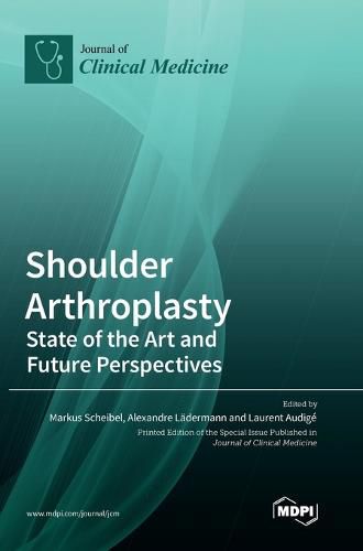 Cover image for Shoulder Arthroplasty