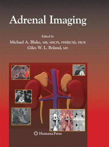 Adrenal Imaging