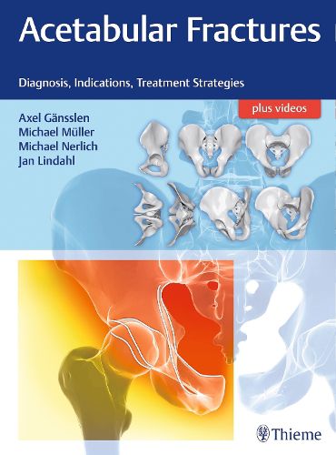 Cover image for Acetabular Fractures: Diagnosis, Indications, Treatment Strategies