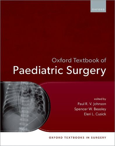 Cover image for Oxford Textbook of Paediatric Surgery