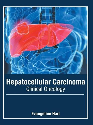 Cover image for Hepatocellular Carcinoma: Clinical Oncology