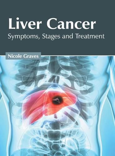 Cover image for Liver Cancer: Symptoms, Stages and Treatment