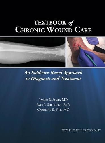 Cover image for Textbook of Chronic Wound Care: An Evidence-Based Approach to Diagnosis Treatment