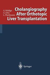 Cover image for Cholangiography After Orthotopic Liver Transplantation