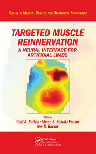 Cover image for Targeted Muscle Reinnervation: A Neural Interface for Artificial Limbs