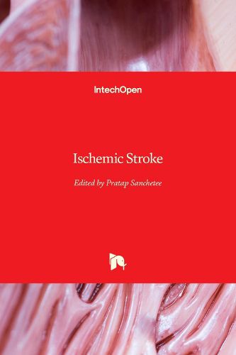 Cover image for Ischemic Stroke