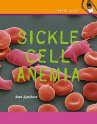 Cover image for Sickle Cell Anemia