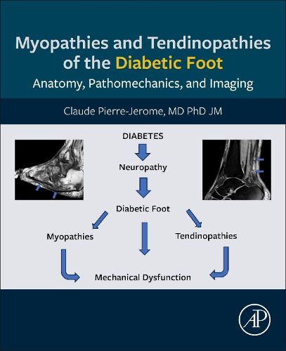 Cover image for Myopathies and Tendinopathies of the Diabetic Foot