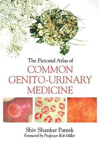 Cover image for The Pictorial Atlas of Common Genito-Urinary Medicine