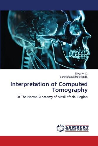 Cover image for Interpretation of Computed Tomography