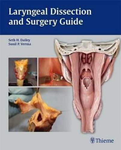 Cover image for Laryngeal Dissection and Surgery Guide