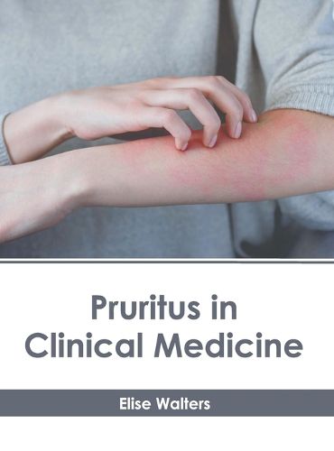 Cover image for Pruritus in Clinical Medicine