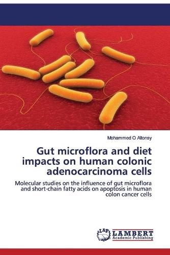 Cover image for Gut microflora and diet impacts on human colonic adenocarcinoma cells