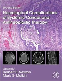 Cover image for Neurological Complications of Systemic Cancer and Antineoplastic Therapy