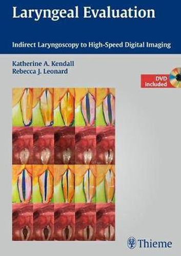 Cover image for Laryngeal Evaluation: Indirect Laryngoscopy to High-Speed Digital Imaging