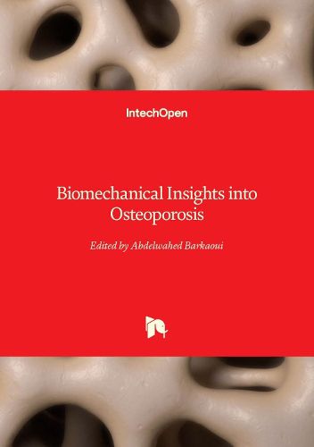 Cover image for Biomechanical Insights into Osteoporosis