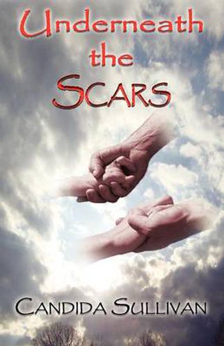 Cover image for Underneath the Scars