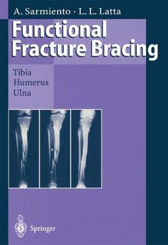 Cover image for Functional Fracture Bracing: Tibia, Humerus, and Ulna