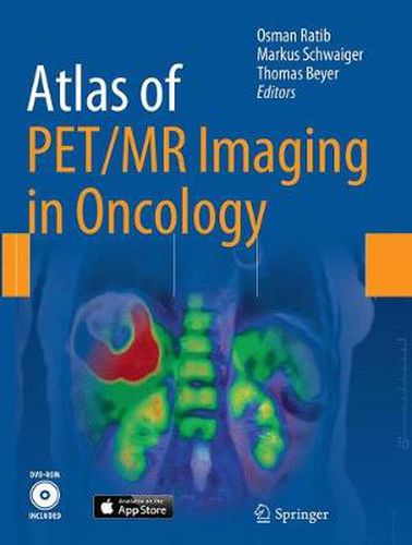 Cover image for Atlas of PET/MR Imaging in Oncology