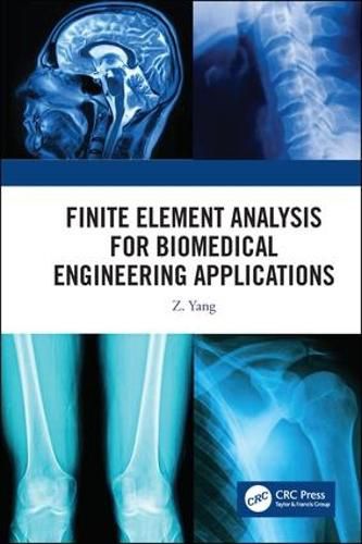 Cover image for Finite Element Analysis for Biomedical Engineering Applications