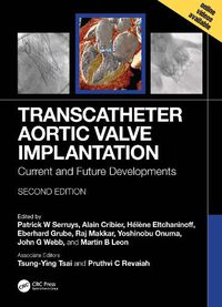 Cover image for Transcatheter Aortic Valve Implantation