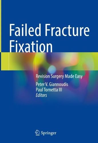 Cover image for Failed Fracture Fixation