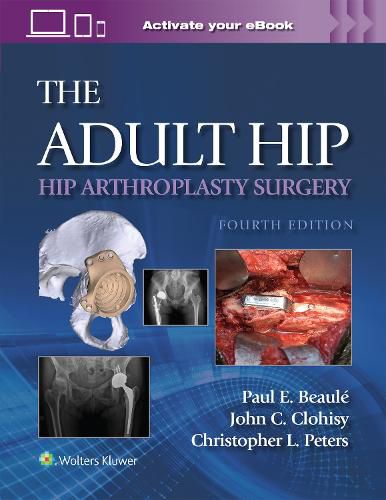 Cover image for The Adult Hip: Hip Arthroplasty Surgery Print + eBook with Multimedia