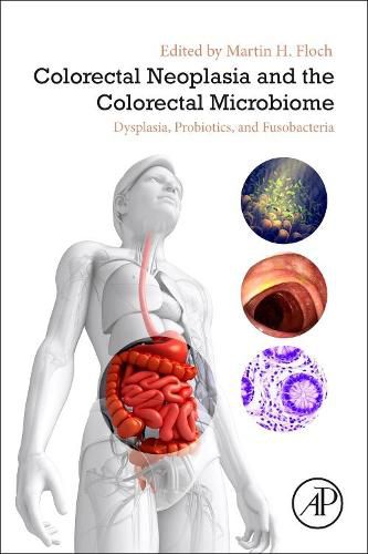 Cover image for Colorectal Neoplasia and the Colorectal Microbiome: Dysplasia, Probiotics, and Fusobacteria