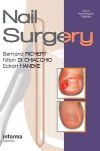 Cover image for Nail Surgery